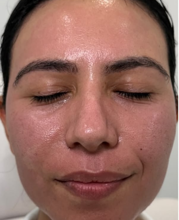 Before Dull Skin